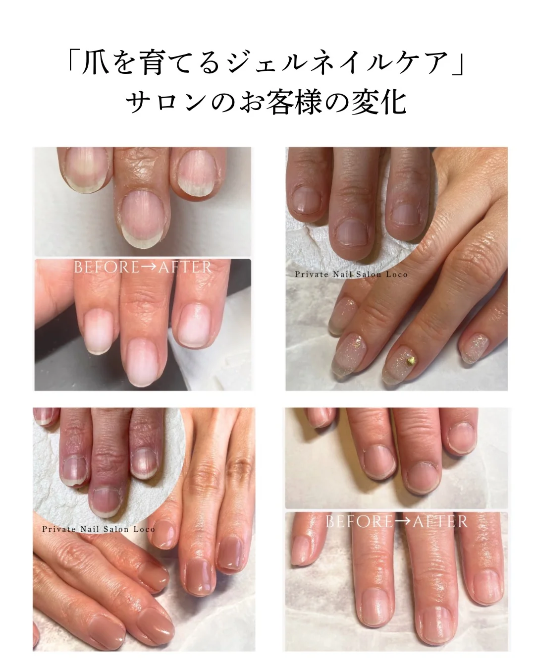 これまでのお客様の爪のBefore・After